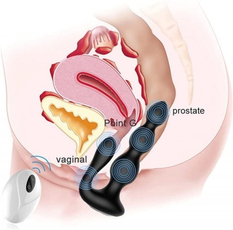 RemoteSilicone AnalBeads RemoteSilicone AnalBeads